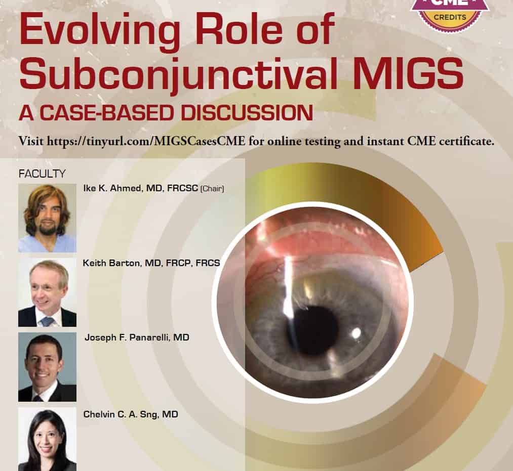 Ophthalmogy Times - Evolving Role of Subconjunctival MIGS pdf