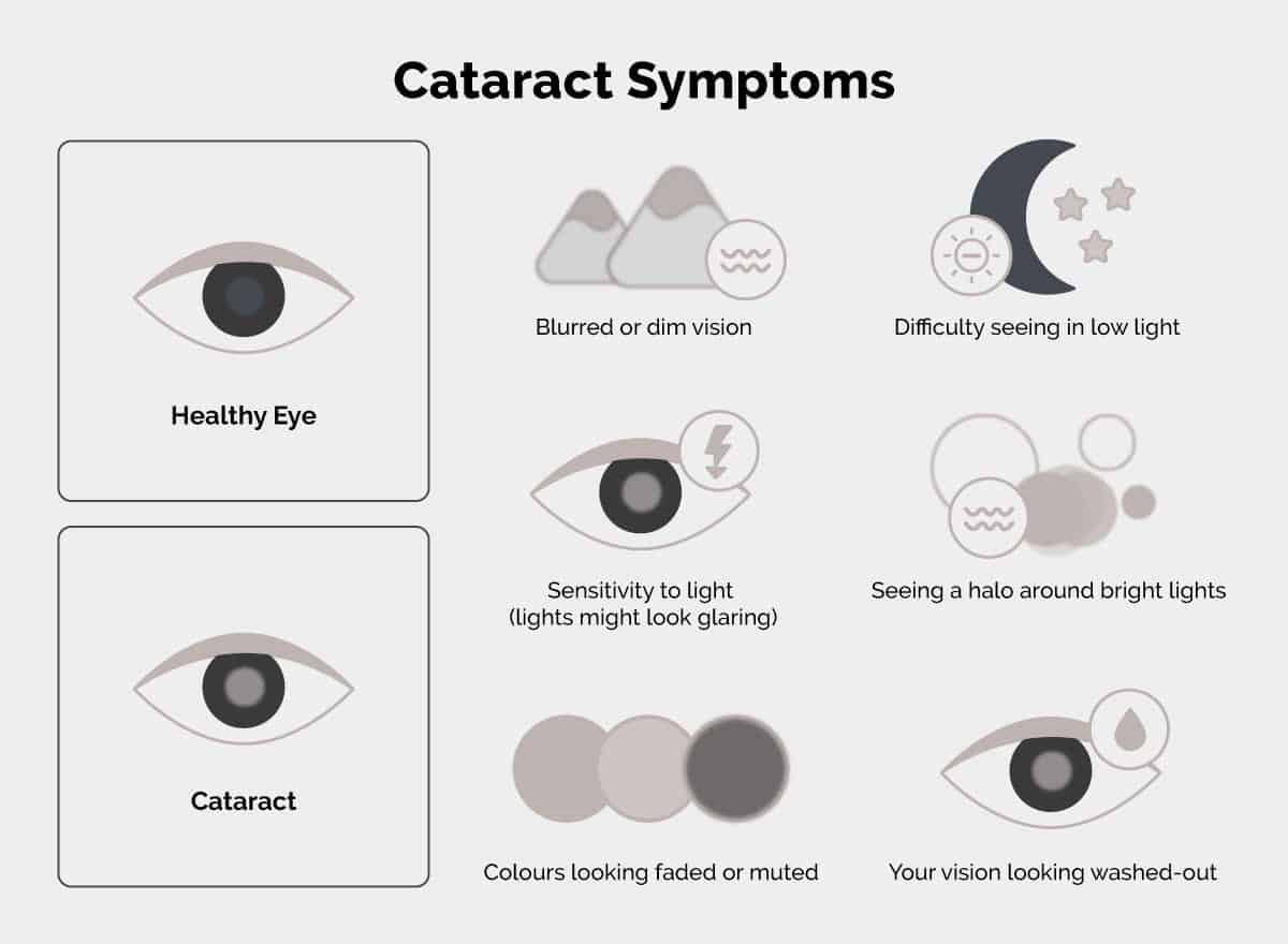 What are some of the common symptoms of cataracts?
