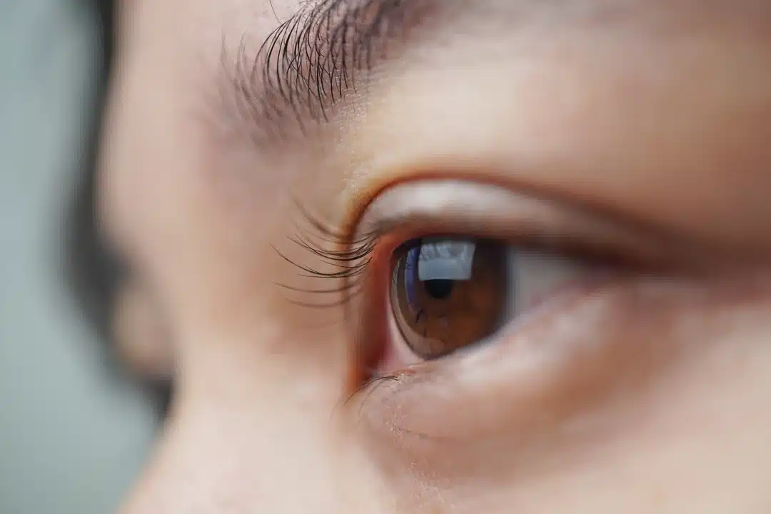 The Paul Glaucoma Implant pdf